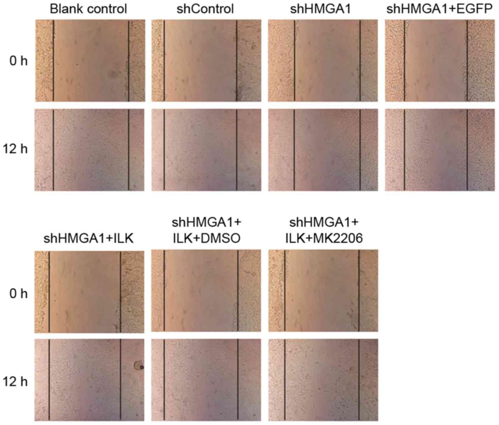 10 Awesome L S Hardwood Floors Inc 2024 free download l s hardwood floors inc of hmga1 participates in mhcc97h cell proliferation and invasion with figure 4 the effects on cell migration in mhcc97h hepatocellular carcinoma cells treated with sh