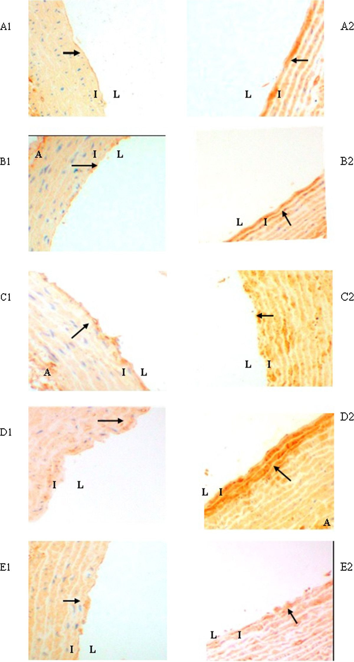 28 Stunning R D Hardwood Floors 2024 free download r d hardwood floors of atorvastatin inhibits the expression of rage induced by advanced within figure 5