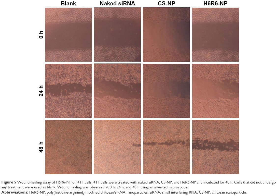 15 Fantastic Z G Hardwood Flooring 2024 free download z g hardwood flooring of full text sirna loaded polyhistidine arginine6 modified chitosan regarding figure 5 wound healing assay of h6r6 np on 4t1 cells 4t1 cells were treated with naked sir